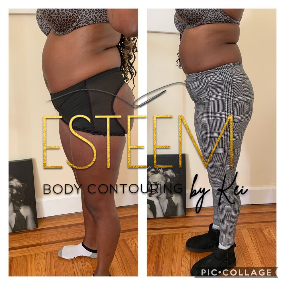 Esteem Body Contour by Kei Logo