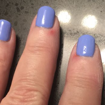 Martini Nails & Spa - On skin around each nail. - Nail Salons Near Me - Omaha, Nebraska