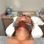 Photo of Aestheta - Ascending Thread Face Lift