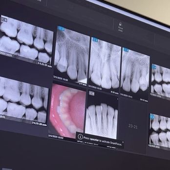 Meadows Dental Group - General Dentistry Near Me - Temecula, California