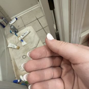 312 Nails & Spa - Nail glue stuck to skin - Nail Salons Near Me - Wheeling, Illinois