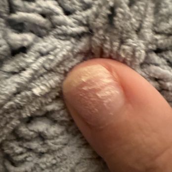 Peace Nail Spa - Damage done after I asked for something that wouldn't damage my nails.... - Nail Salons Near Me - Richardson, Texas Peace Nail Spa - Damage done after I asked for something that wouldn't damage my nails.... - Nail Salons Near Me - Richardson, Texas