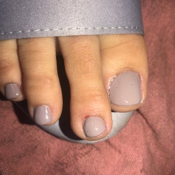 Tip To Toe Nail Salon - One of 2 bleeding toes, uneven filing, nailpolish bubbles. - Nail Salons Near Me - Wauwatosa, Wisconsin