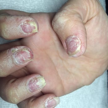 7 Day Spa & Nails - Aftermath of going to 7 day nail salon for two years.... - Nail Salons Near Me - Tempe, Arizona 7 Day Spa & Nails - Aftermath of going to 7 day nail salon for two years.... - Nail Salons Near Me - Tempe, Arizona
