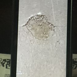 Pothole and debris *on the way to surgery*