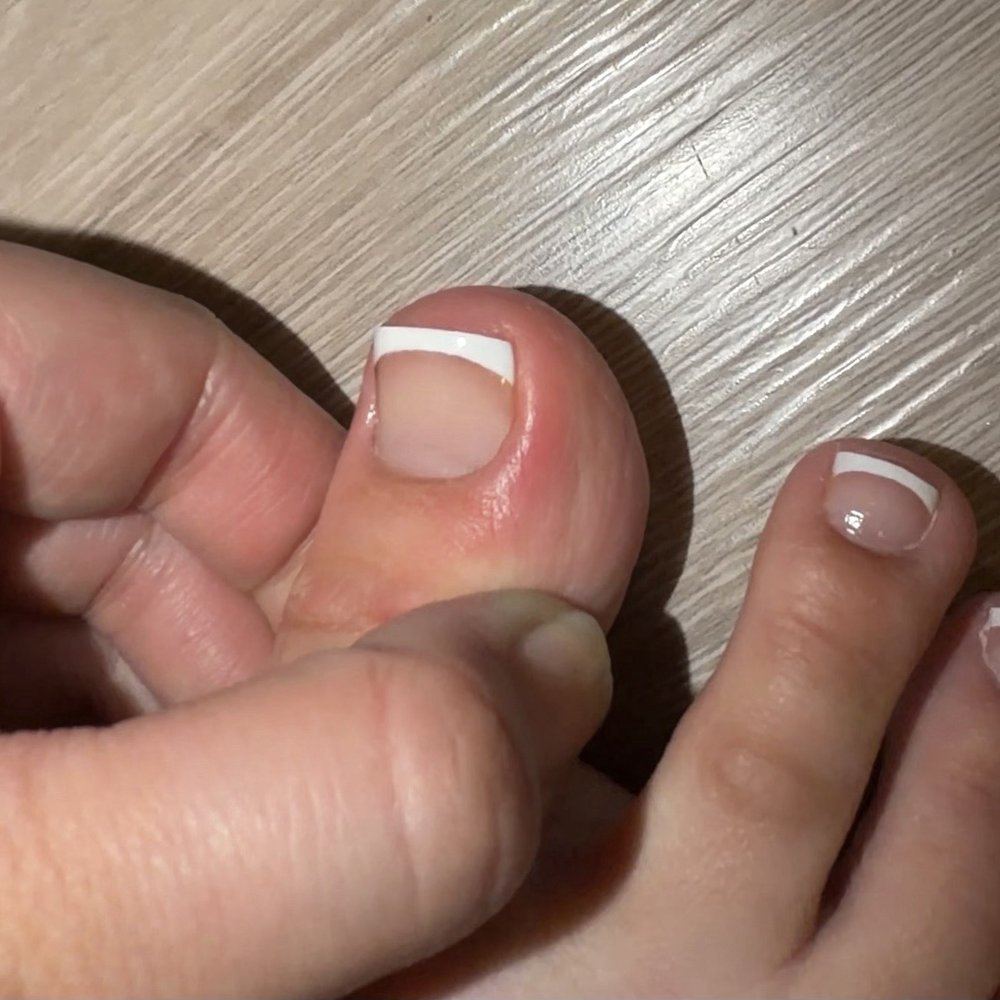 ChaNails Spa - Ouch, red and inflamed - Nail Salons Near Me - Morgan Hill, California