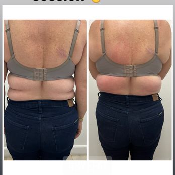 The Beauty Whisperer - Body sculpting - Medical Spas Near Me - Chino, California The Beauty Whisperer - Body sculpting - Medical Spas Near Me - Chino, California