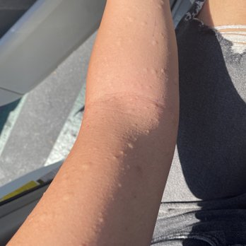 European Wax Center - Hives - Waxing Near Me - Irvine, California European Wax Center - Hives - Waxing Near Me - Irvine, California
