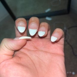 Chipped bubbles in nails