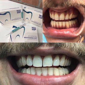 Whitening Saloon on Yelp