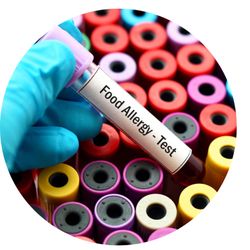 Nutritionally Yours - Food allergy and intolerance testing provides you with food clarity.