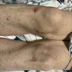 NYU Langone Hospital - Scraped knees and a head ct .