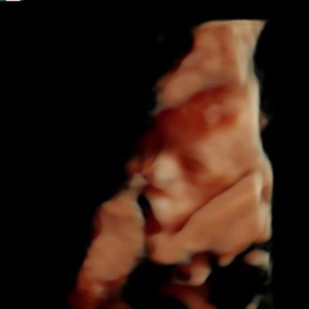 Barefoot Babies - Ultrasound Imaging Centers Near Me - Fayetteville, North Carolina Barefoot Babies - Ultrasound Imaging Centers Near Me - Fayetteville, North Carolina