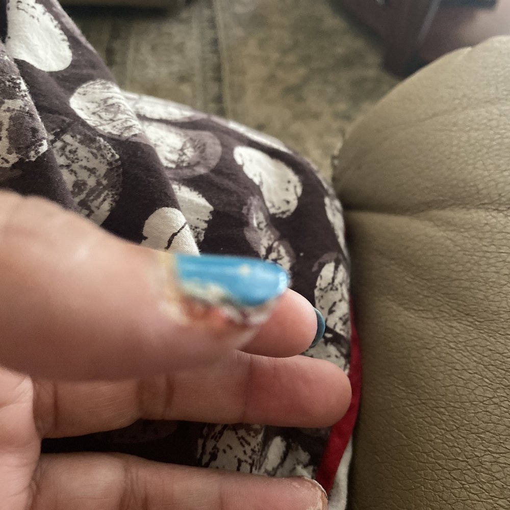 Royal Nails - Nail infection after manicure - Nail Salons Near Me - Bakersfield, California Royal Nails - Nail infection after manicure - Nail Salons Near Me - Bakersfield, California