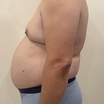 Sergey Lyass, MD - same as before - Cosmetic Surgeons Near Me - Los Angeles, California Sergey Lyass, MD - same as before - Cosmetic Surgeons Near Me - Los Angeles, California