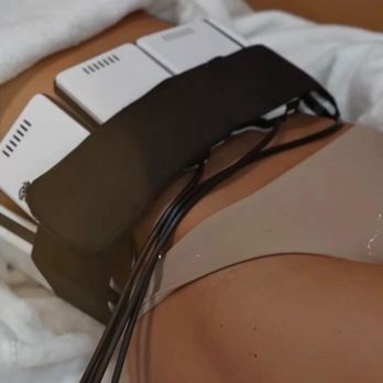 Callista Beauty and Spa - EMS Sculpting uses electrical muscle stimulation to tone muscles and enhance body contour. It helps build muscle and reduce fat in targeted. - Skin Care Near Me - Chicago, Illinois Callista Beauty and Spa - EMS Sculpting uses electrical muscle stimulation to tone muscles and enhance body contour. It helps build muscle and reduce fat in targeted. - Skin Care Near Me - Chicago, Illinois