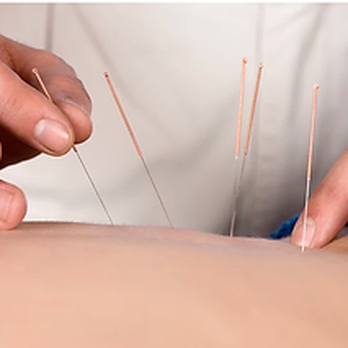 Pink Heart Acupuncture & More - Acupuncture Near Me - Orlando, Florida Pink Heart Acupuncture & More - Acupuncture Near Me - Orlando, Florida