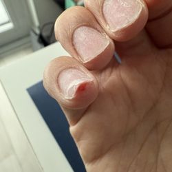 Chloe's Nails & Spa - Ouch