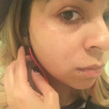 Perfect Brows NYC - The other side of my face also had minor irritation/ burn. - Eyelash Service Near Me - New York, New York Perfect Brows NYC - The other side of my face also had minor irritation/ burn. - Eyelash Service Near Me - New York, New York