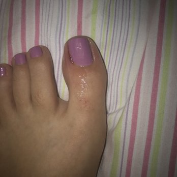 Angel Nails - Got a pedicure and the next day I woke up with my big toe infected - Nail Salons Near Me - Hillside, New Jersey Angel Nails - Got a pedicure and the next day I woke up with my big toe infected - Nail Salons Near Me - Hillside, New Jersey