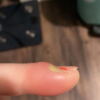 Fancy Nails & Spa - Update on my finger - Nail Salons Near Me - New Albany, Indiana Fancy Nails & Spa - Update on my finger - Nail Salons Near Me - New Albany, Indiana