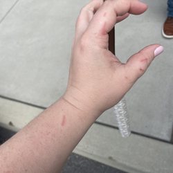 Blue Moon Florist - Cuts on wrist and fingers from not de-thorning the roses in her wedding bouquet.