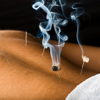 Daniel Haun, LAc - warming needle therapy - Acupuncture Near Me - Oceanside, California Daniel Haun, LAc - warming needle therapy - Acupuncture Near Me - Oceanside, California