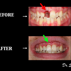 Whitemarsh Family Dentistry