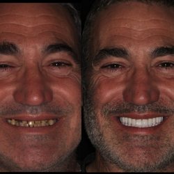 Stone Ridge Dental