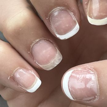 Lux's Nail Spa - Bad nails Day 3 - Nail Salons Near Me - Joplin, Missouri Lux's Nail Spa - Bad nails Day 3 - Nail Salons Near Me - Joplin, Missouri