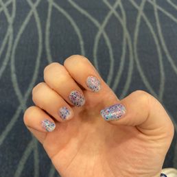 Broken ring finger, chipped pointer and thumb worst SNS application ever