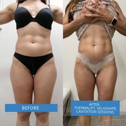 Le Corps - With our treatments you will look and feel fantastic. Measurable results are guaranteed https://www.lecorpsculpting.com