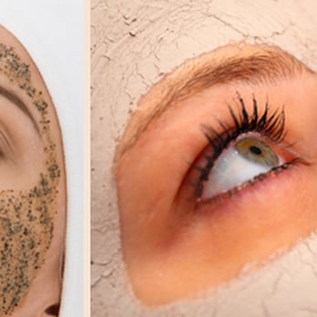 zAesthetics - Skin Care Near Me - San Jose, California