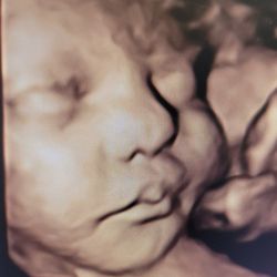 My Baby's First Images