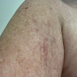 St. Joseph's/Candler Urgent Care