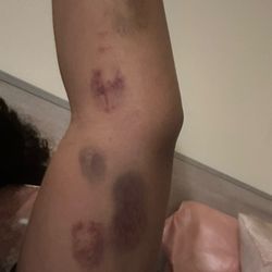 UCLA Health Downtown Los Angeles Primary & Specialty Care - Brusses from ED care