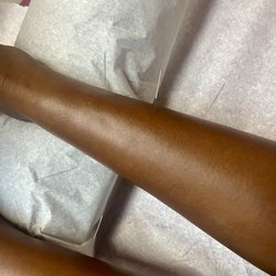 Anita Lanier, OMD - My leg with acupuncture needles