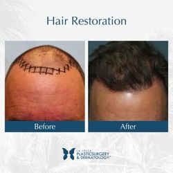 La Jolla Plastic Surgery & Dermatology