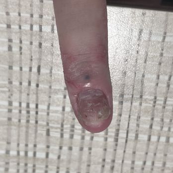 Dila Nails and Spa - my nail after going to dial - Waxing Near Me - Stockton, California Dila Nails and Spa - my nail after going to dial - Waxing Near Me - Stockton, California