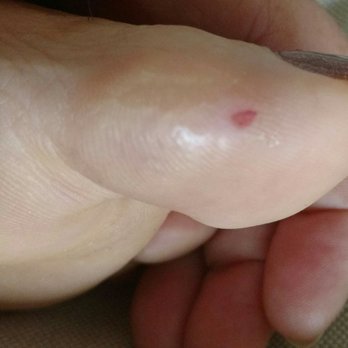 Crystal Nails - Hair Removal Near Me - New Westminster, British Columbia