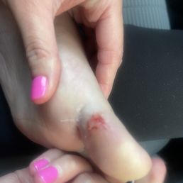 Zero reasons why this should happen at a professional nail salon. Zero reasons why this should happen at a professional nail salon.
