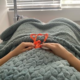 Acupuncture for chronic migraine