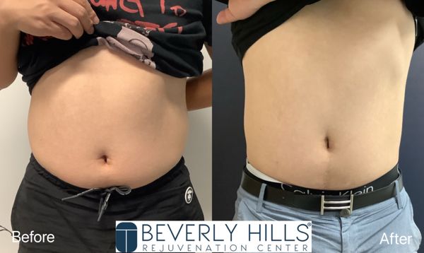 Beverly Hills Rejuvenation Center Westlake Village by null
