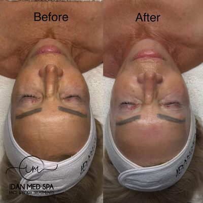 Idan Med Spa by null