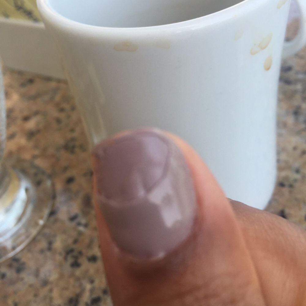 Venus Nail Spa - Bubbling,cracking and lifting of gel polish the very next day! - Nail Salons Near Me - Rocklin, California Venus Nail Spa - Bubbling,cracking and lifting of gel polish the very next day! - Nail Salons Near Me - Rocklin, California