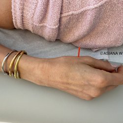 Acupuncture for Improved Circulation and Wellness
