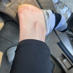 DD Nail &Spa - Skinned foot after pedicure.