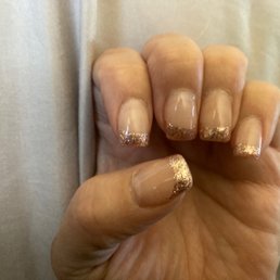 Left hand looks the same as my right, after 2-Weeks done elsewhere. Left hand looks the same as my right, after 2-Weeks done elsewhere.