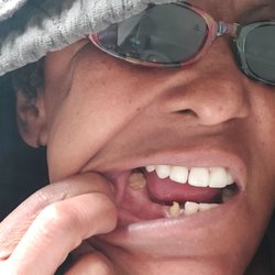Vistaview Dental Care - Slaughter of my left jaw.