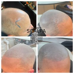 Scalp Aesthetics Dearborn